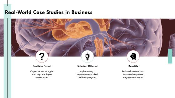 Exploring The Complexities Of Brain Architecture PPT Sample AT Slide19