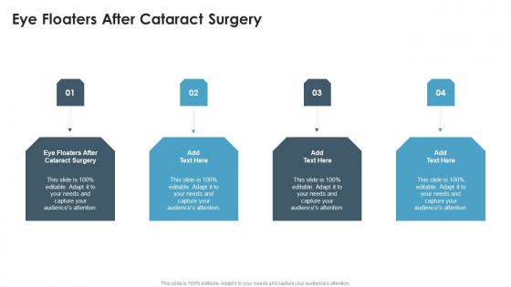 Eye Floaters After Cataract Surgery In Powerpoint And Google Slides Cpb