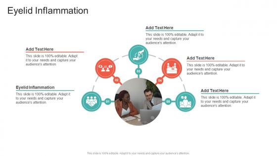 Eyelid Inflammation In Powerpoint And Google Slides Cpb