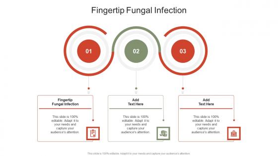 Fingertip Fungal Infection In Powerpoint And Google Slides Cpb