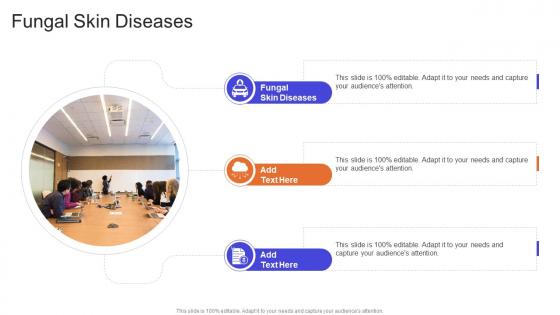 Fungal Skin Diseases In Powerpoint And Google Slides Cpb