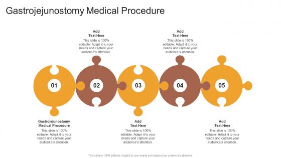 Gastrojejunostomy Medical Procedure In Powerpoint And Google Slides Cpb