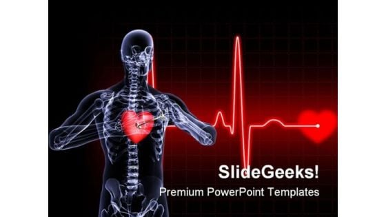 Heart Xray Medical PowerPoint Templates And PowerPoint Backgrounds 0811