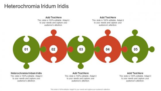 Heterochromia Iridum Iridis In Powerpoint And Google Slides Cpb