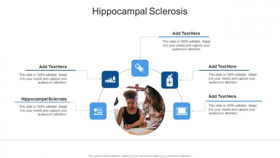 Hippocampal Sclerosis In Powerpoint And Google Slides Cpb