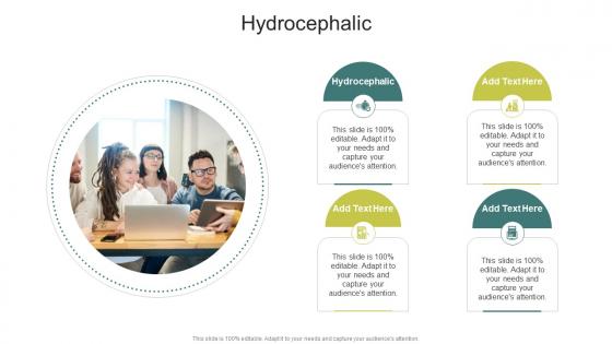 Hydrocephalic In Powerpoint And Google Slides Cpb