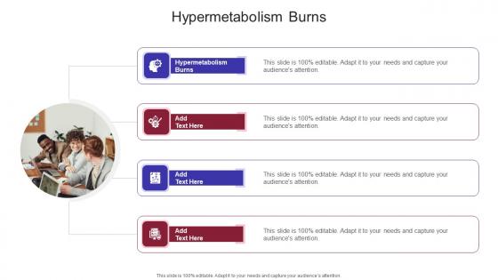 Hypermetabolism Burns In Powerpoint And Google Slides Cpb