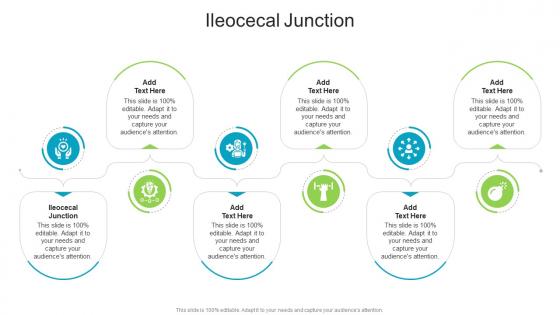 Ileocecal Junction In Powerpoint And Google Slides Cpb