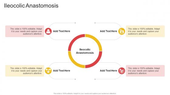 Ileocolic Anastomosis In Powerpoint And Google Slides Cpb