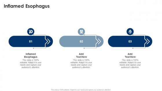 Inflamed Esophagus In Powerpoint And Google Slides Cpb