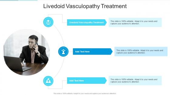 Livedoid Vasculopathy Treatment In Powerpoint And Google Slides Cpb