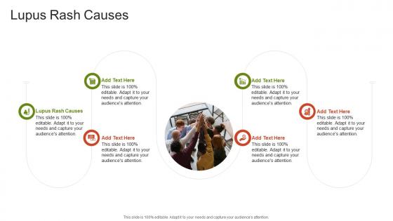 Lupus Rash Causes In Powerpoint And Google Slides Cpb