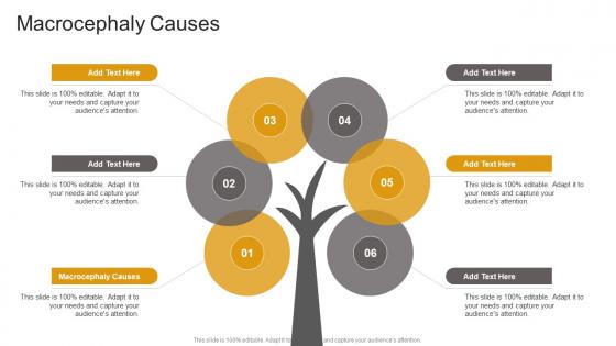 Macrocephaly Causes In Powerpoint And Google Slides Cpb