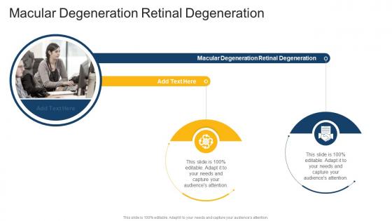 Macular Degeneration Retinal Degeneration In Powerpoint And Google Slides Cpb