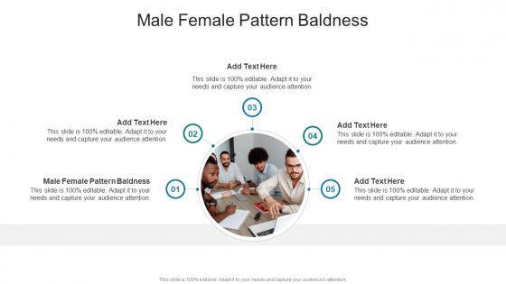 Male Female Pattern Baldness In Powerpoint And Google Slides Cpb