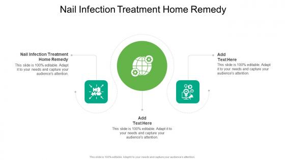 Nail Infection Treatment Home Remedy In Powerpoint And Google Slides Cpb