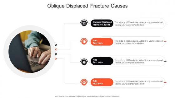 Oblique Displaced Fracture Causes In Powerpoint And Google Slides Cpb
