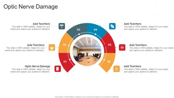 Optic Nerve Damage In Powerpoint And Google Slides Cpb