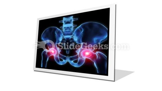 Pain In Hips PowerPoint Icon F