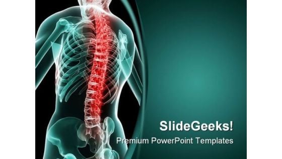 Painful Spine Medical PowerPoint Backgrounds And Templates 1210