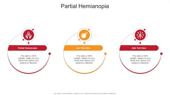 Partial Hemianopia In Powerpoint And Google Slides Cpb