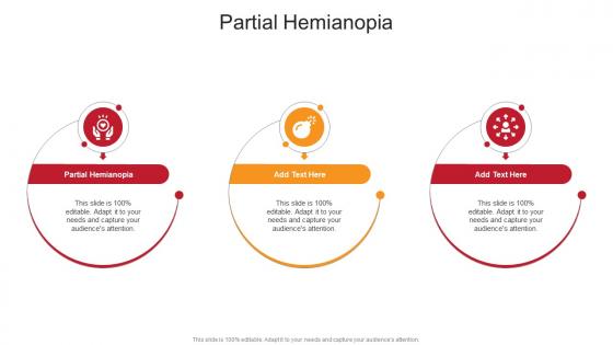 Partial Hemianopia In Powerpoint And Google Slides Cpb