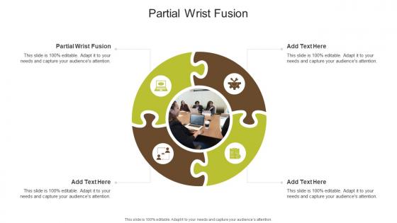 Partial Wrist Fusion In Powerpoint And Google Slides Cpb