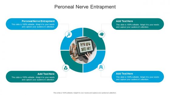 Peroneal Nerve Entrapment In Powerpoint And Google Slides Cpb