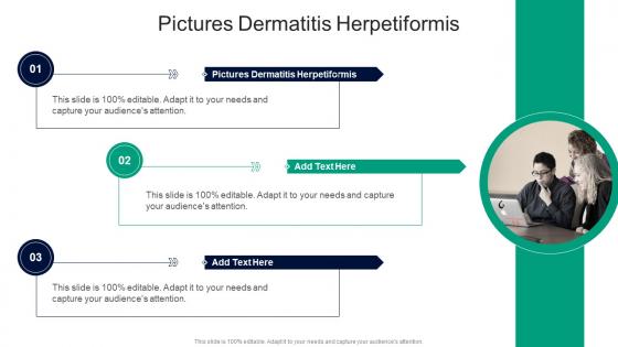 Pictures Dermatitis Herpetiformis In Powerpoint And Google Slides Cpb