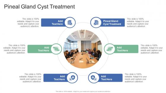 Pineal Gland Cyst Treatment In Powerpoint And Google Slides Cpb