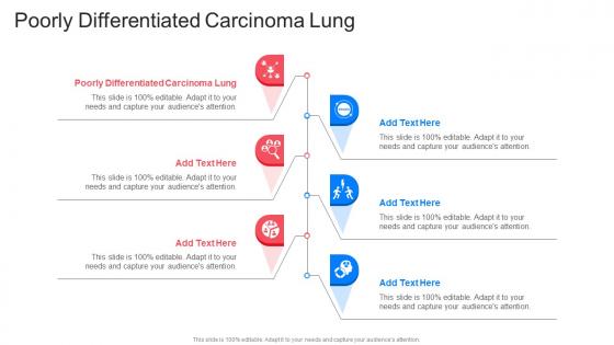 Poorly Differentiated Carcinoma Lung In Powerpoint And Google Slides Cpb
