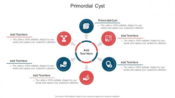 Primordial Cyst In Powerpoint And Google Slides Cpb