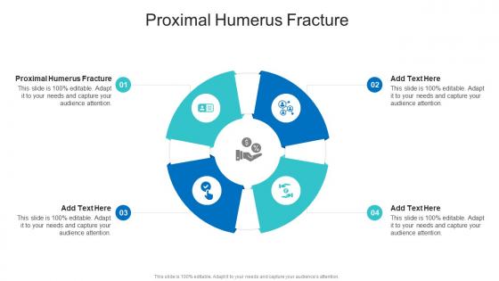 Proximal Humerus Fracture In Powerpoint And Google Slides Cpb