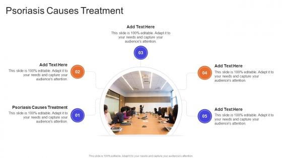 Psoriasis Causes Treatment In Powerpoint And Google Slides Cpb