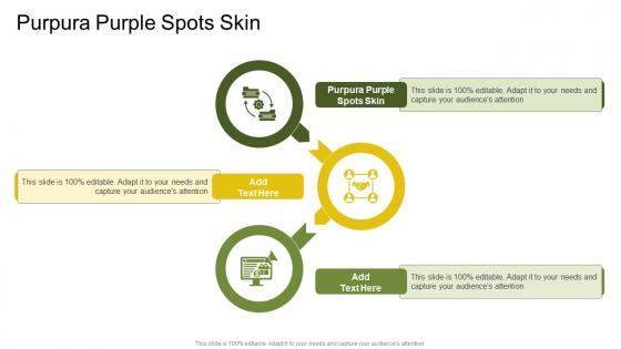 Purpura Purple Spots Skin In Powerpoint And Google Slides Cpb Purpura Purple Spots Skin In Powerpoint And Google Slides Cpb