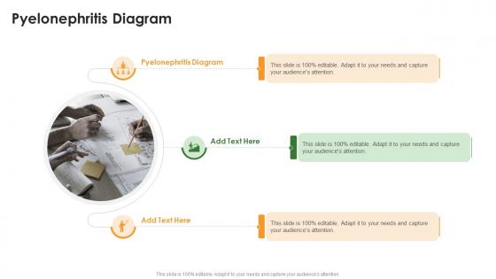 Pyelonephritis Diagram In Powerpoint And Google Slides Cpb