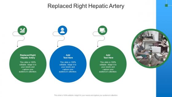 Replaced Right Hepatic Artery In Powerpoint And Google Slides Cpb