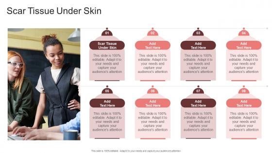Scar Tissue Under Skin In Powerpoint And Google Slides Cpb