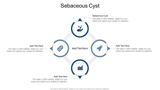 Sebaceous Cyst In Powerpoint And Google Slides Cpb Sebaceous Cyst In Powerpoint And Google Slides Cpb