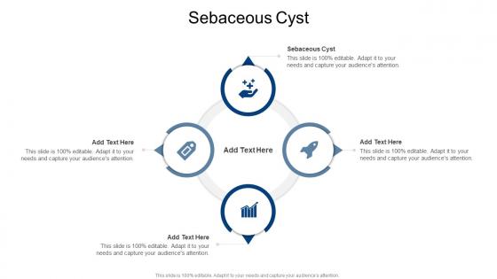 Sebaceous Cyst In Powerpoint And Google Slides Cpb