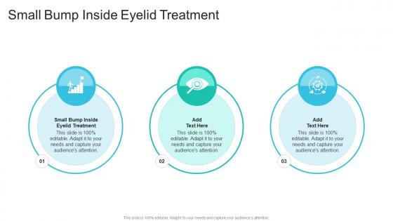 Small Bump Inside Eyelid Treatment In Powerpoint And Google Slides Cpb