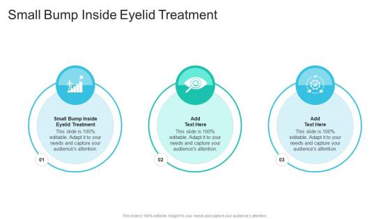 Small Bump Inside Eyelid Treatment In Powerpoint And Google Slides Cpb Small Bump Inside Eyelid Treatment In Powerpoint And Google Slides Cpb