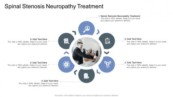 Spinal Stenosis Neuropathy Treatment In Powerpoint And Google Slides Cpb