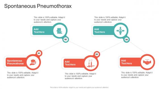 Spontaneous Pneumothorax In Powerpoint And Google Slides Cpb