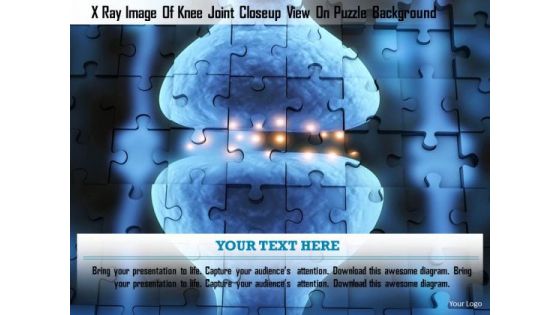 Stock Photo X Ray Image Of Knee Joint Closeup View On Puzzle Background PowerPoint Slide