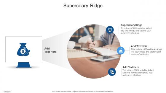 Superciliary Ridge In Powerpoint And Google Slides Cpb