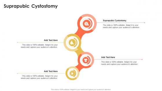 Suprapubic Cystostomy In Powerpoint And Google Slides Cpb