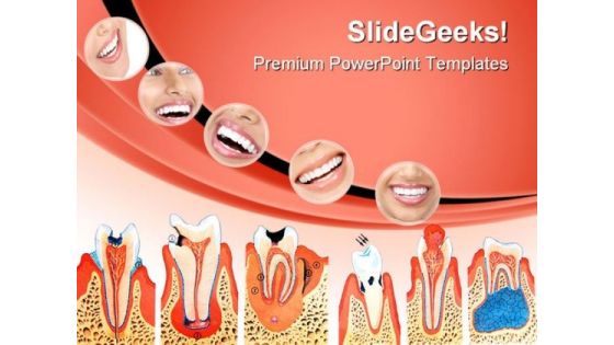 Teeth Illustration Dental PowerPoint Templates And PowerPoint Backgrounds 0411