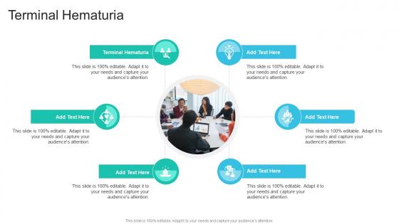 Terminal Hematuria In Powerpoint And Google Slides Cpb