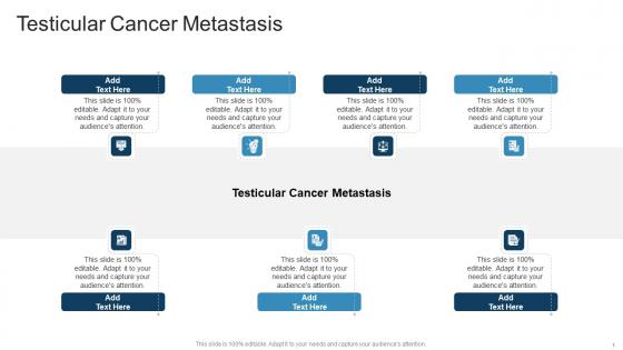 Testicular Cancer Metastasis In Powerpoint And Google Slides Cpb